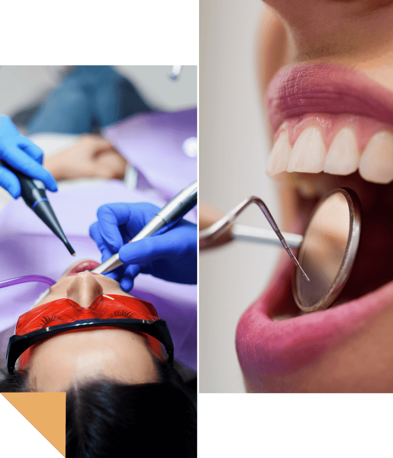 dental-services-img